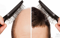 درمان ریزش موی مردان در طب سنتی