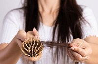 روش های جلوگیری از ریزش مو در زنان
