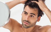 دلایل ریزش مو در مردان