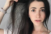 علت ریزش مو در دختران جوان چیست؟