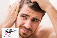 روش درمانی ریزش مو در مردان