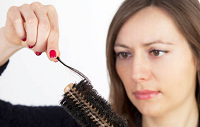 درمان ریزش موی هورمونی در خانم ها