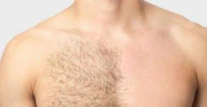 علت‌‌ ریزش موی بدن مردان چیست؟
