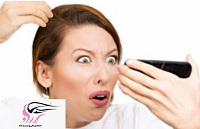 بهترین درمان ریزش موی شدید در خانم ها