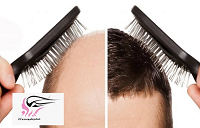 دلیل اصلی ریزش مو در مردان جوان