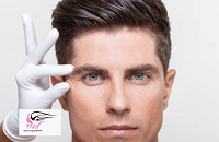 درمان پف بالای چشم مردان