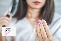 درمان ریزش مو شدید در خانم ها