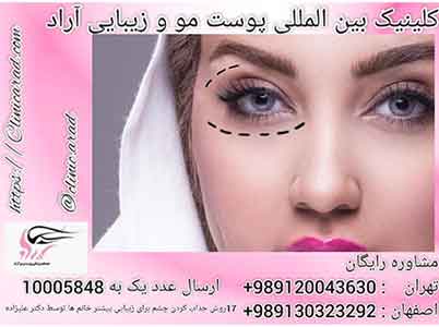 17 روش جذاب کردن چشم برای زیبایی بیشتر خانم ها توسط دکتر علیزاده