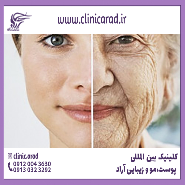 مهمترین عوامل پیر شدن پوست چیست ؟