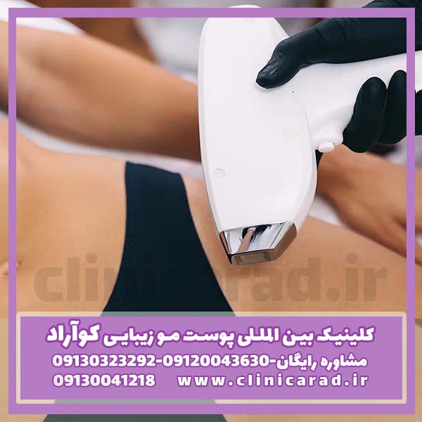 قبل لیزر سفیدی واژن چه مراقبتی لازم است؟ - کلینیک تخصصی پوست مو زیبایی آراد